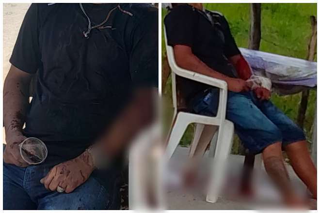 Homem Executado A Tiros Enquanto Bebia Amigos Na Zona Da Mata De